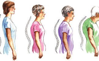 Osteoporoz nedir? Fizik Tedavi ve Rehabilitasyon Uzmanı yazdı…