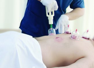 Kupa Tedavisinin (Hacamat) Faydaları Nelerdir?